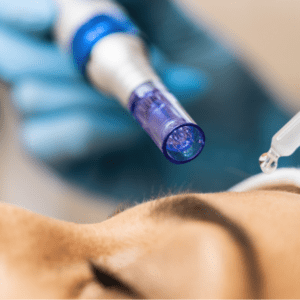 Curso de MICRONEEDLING (DERMAPEN)
